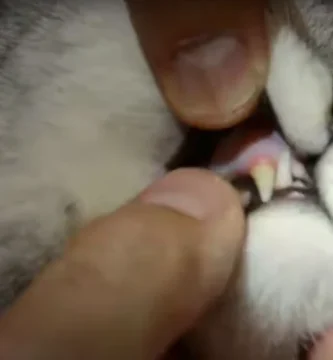 higiene dental